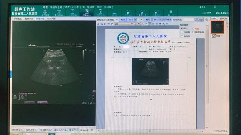 根据我国公务员体检标准，转氨酶的正常范围如下：